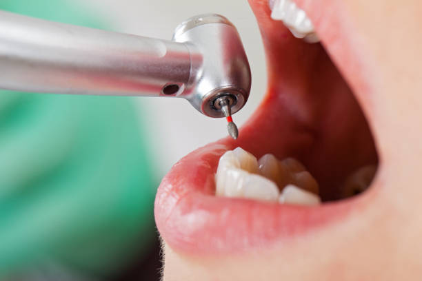 Best Emergency Treatment for Oral Infections in Wilmore, KY